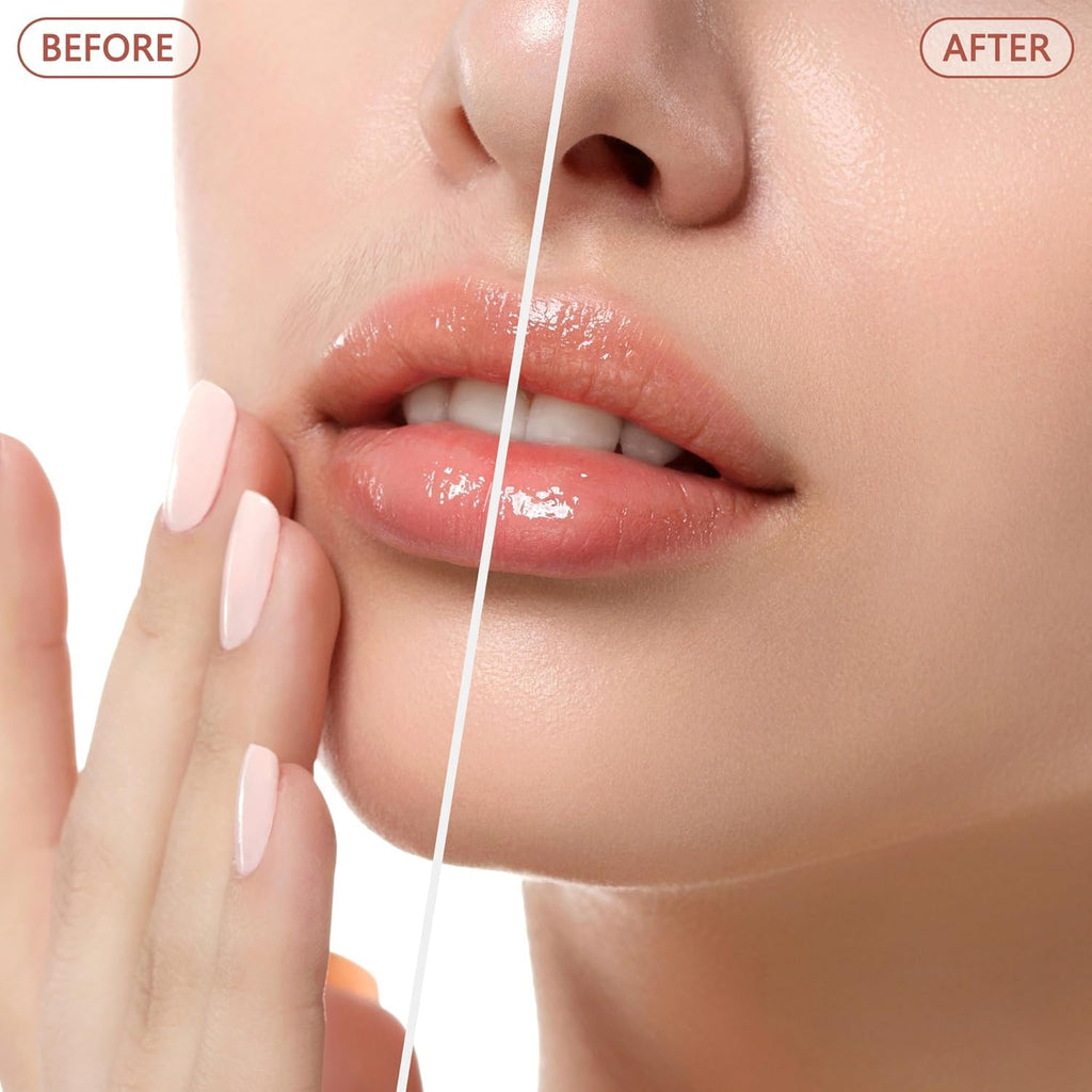 Facial Hair Remover for Women - as Seen on TV Painless Face Shaver - Electric Hair Removal Device for Face Lips Peach Fuzz with Light (Rose Gold)
