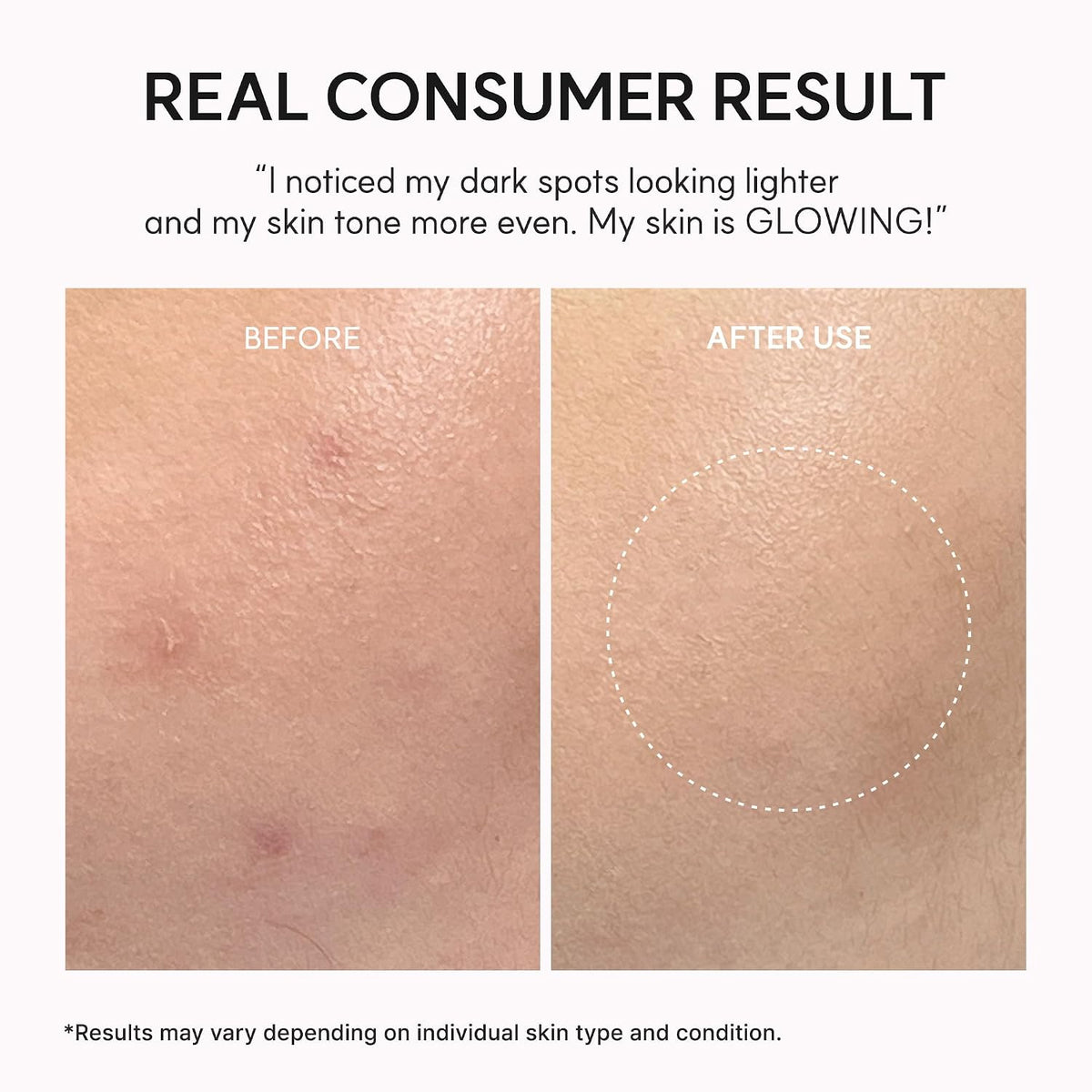 Arencia TXA Booster Shot Serum with 5% Tranexamic Acid & Peptides, Skin Tone Balancing & Hydration Support, Lightweight Daily Skincare, 30 mL / 1.01 fl. oz.