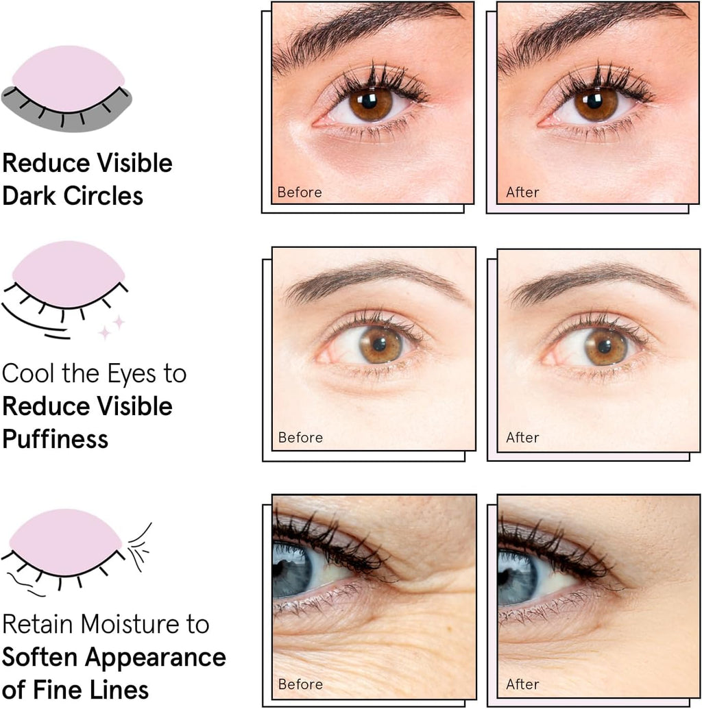 grace & stella Award Winning Eye Patches for Puffy Eyes - Birthday Gifts for Women - Under Eye Mask for Dark Circles and Undereye Bags - Gifts for Mom - Vegan Cruelty-Free Self Care (24 Pairs, Gold)