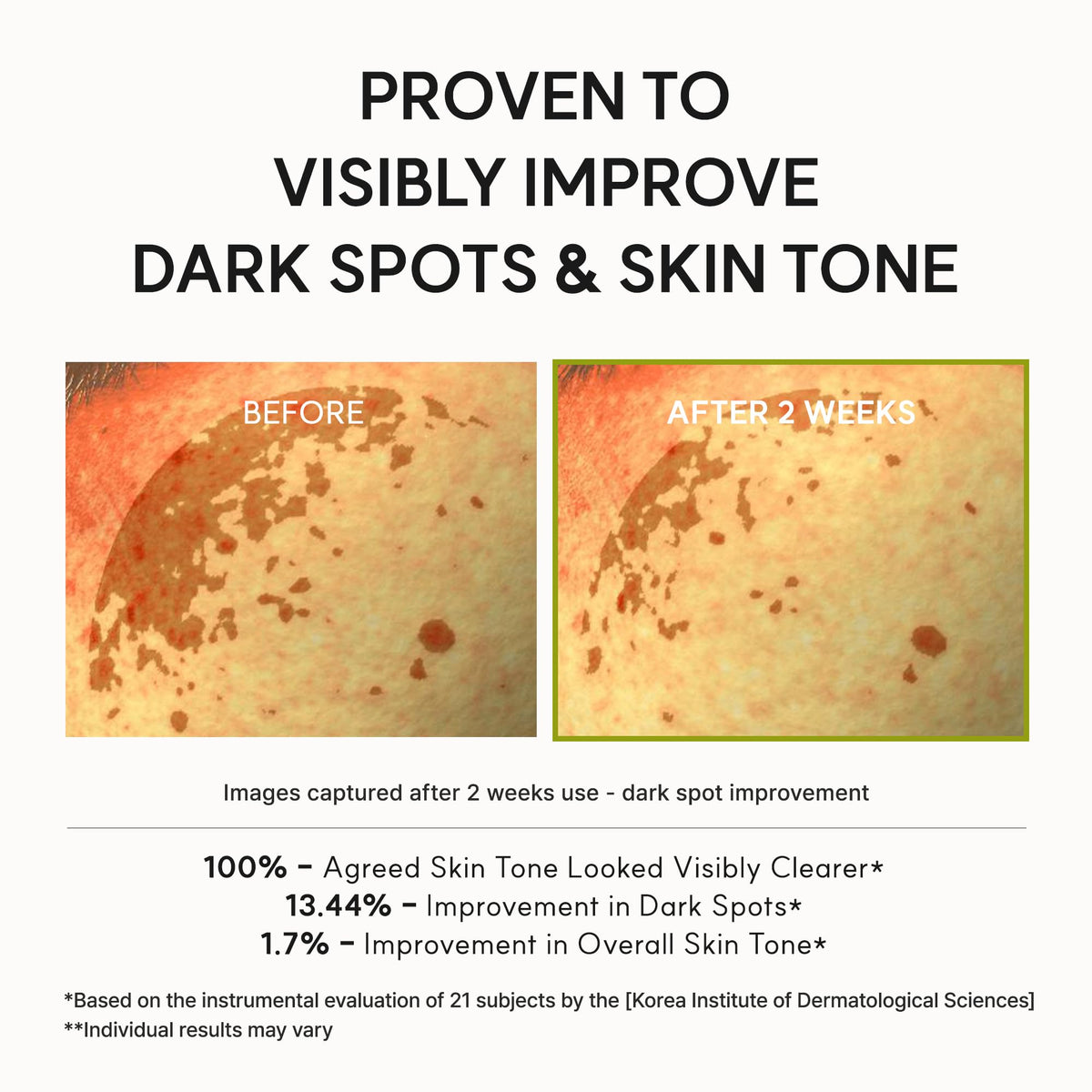 Arencia TXA Booster Shot Serum with 5% Tranexamic Acid & Peptides, Skin Tone Balancing & Hydration Support, Lightweight Daily Skincare, 30 mL / 1.01 fl. oz.