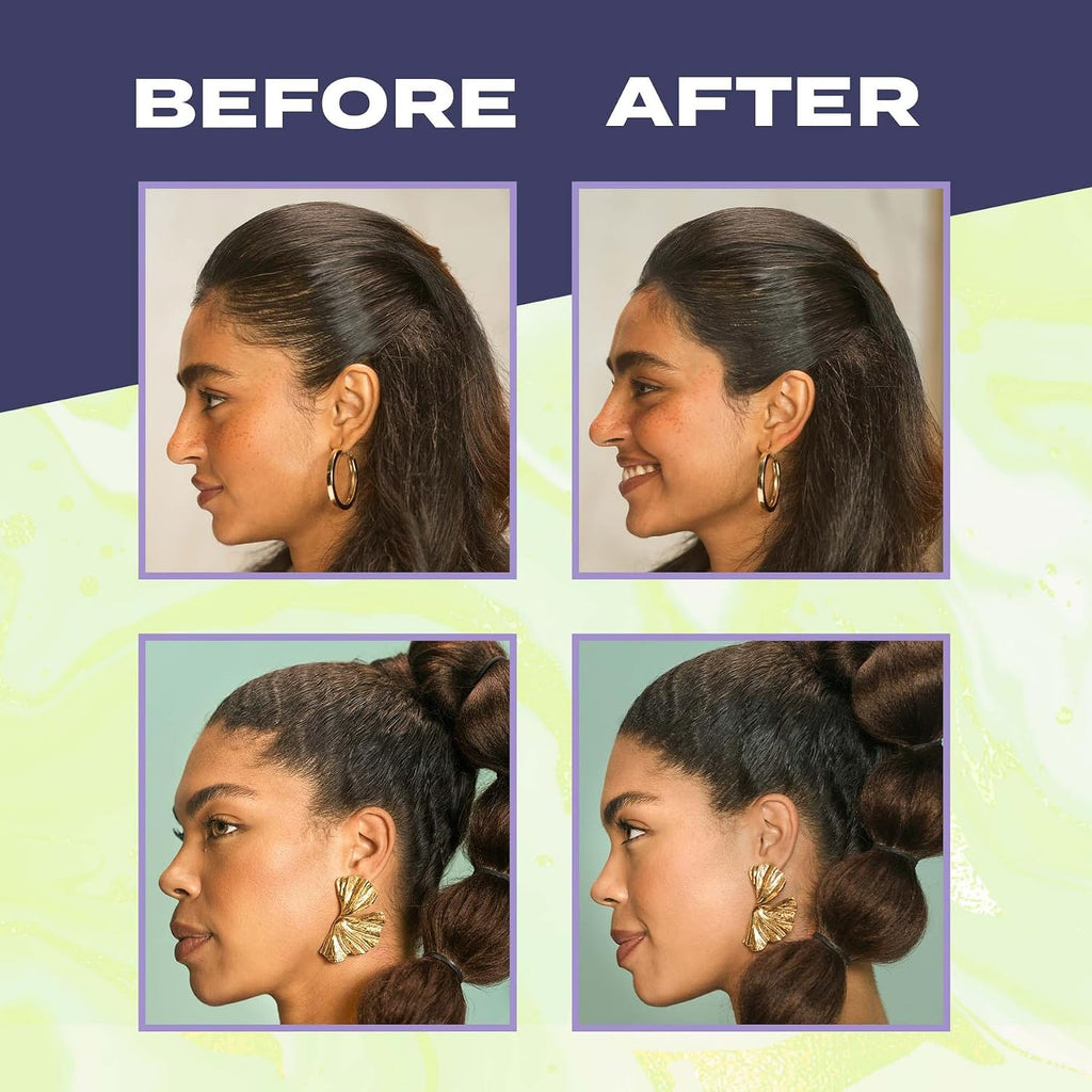 Toppik Hair Building Fibers, Fill In Fine or Thinning Hair Instantly Thicker, Fuller Looking Hair 9 Shades,4 size options
